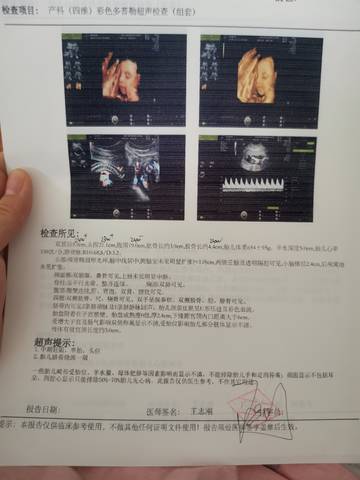 journal_insert_pic_1681905825