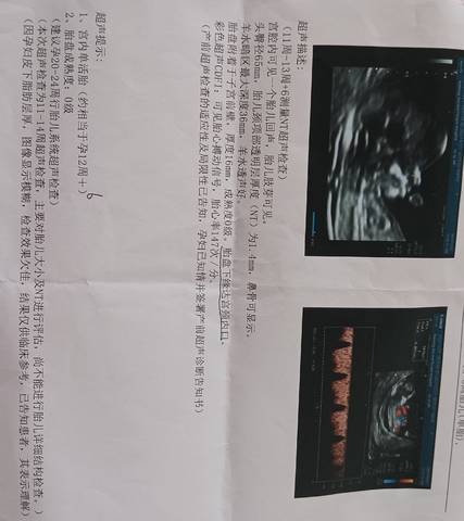 journal_insert_pic_1688408201