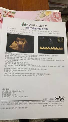 journal_insert_pic_1689819111