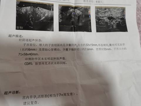 journal_insert_pic_1677679415