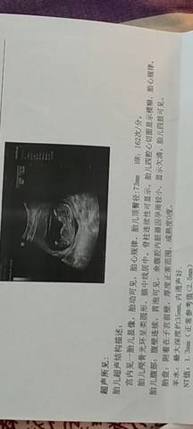 journal_insert_pic_1674602349