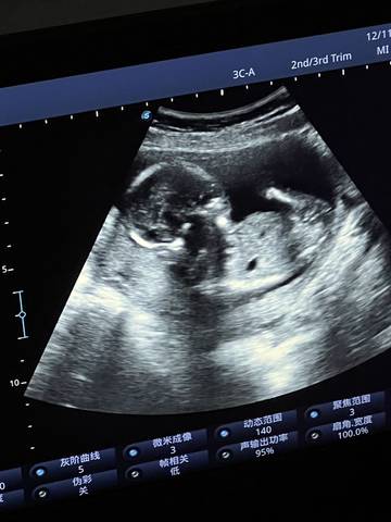 journal_insert_pic_1678140553