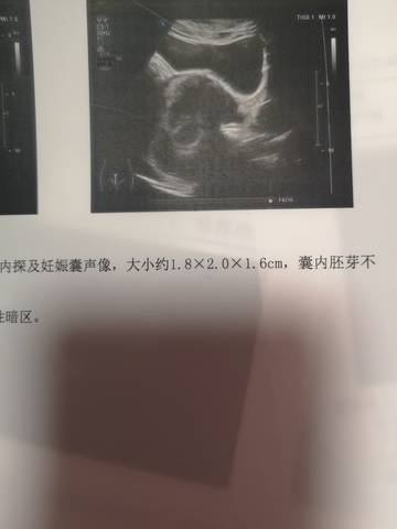 journal_insert_pic_1679886230