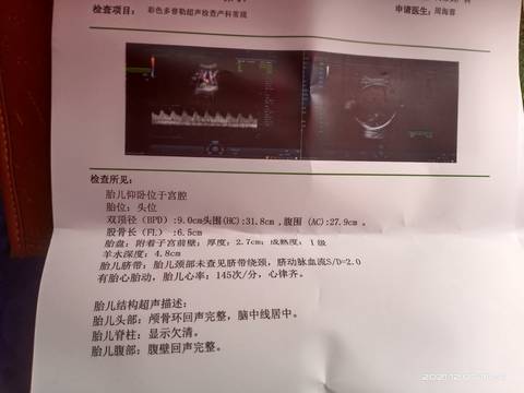 journal_insert_pic_1674217563