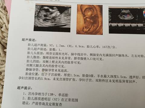 journal_insert_pic_1685303921