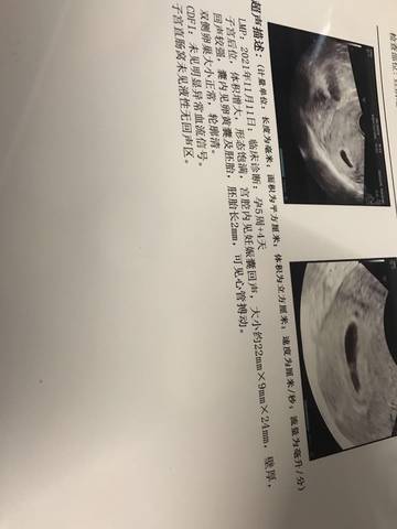journal_insert_pic_1683017447