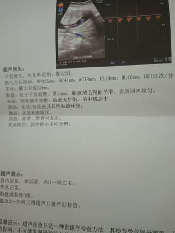 journal_insert_pic_1719455842