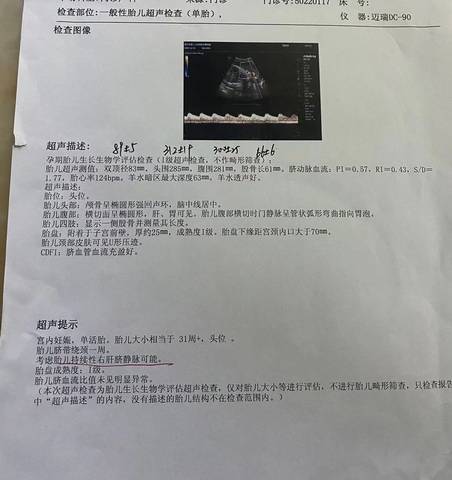 journal_insert_pic_1677682916