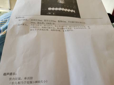 journal_insert_pic_1674755987