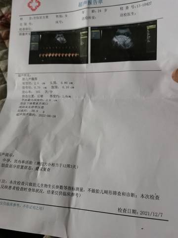 journal_insert_pic_1675501849
