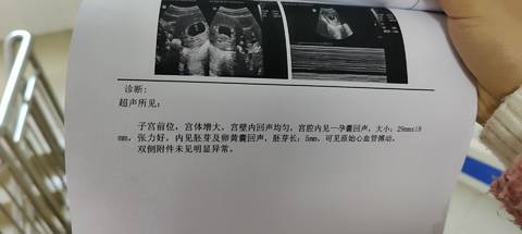 journal_insert_pic_1685344377