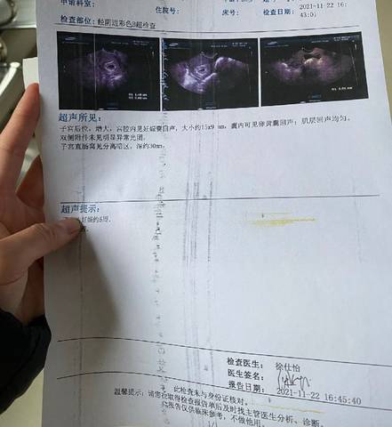 journal_insert_pic_1677487816