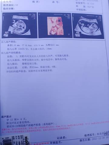 journal_insert_pic_1689230024