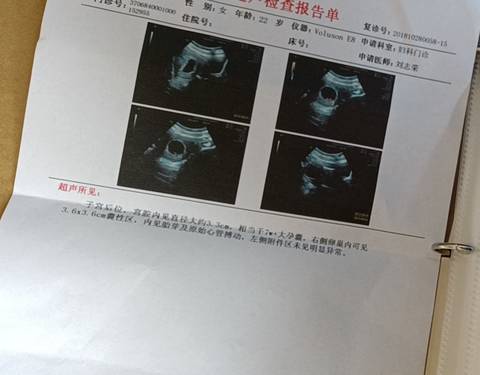 journal_insert_pic_1688674978