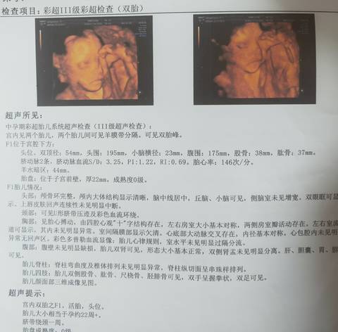 journal_insert_pic_1675084422