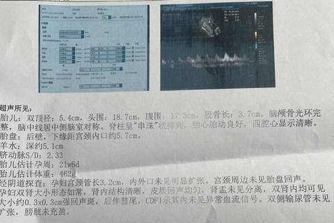 journal_insert_pic_1685249464