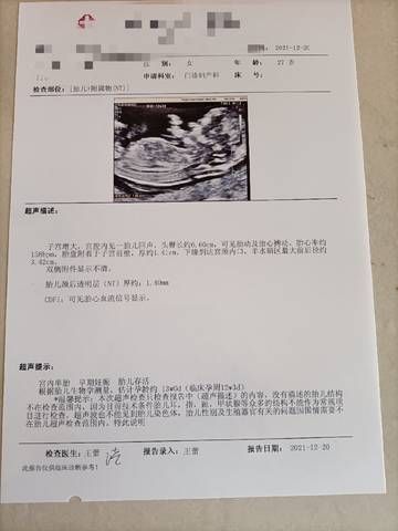 journal_insert_pic_1682998511