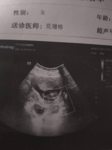 journal_insert_pic_1682206163