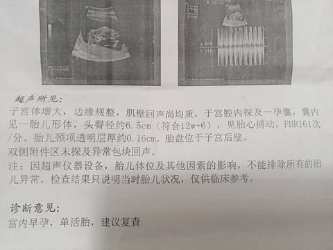 journal_insert_pic_1678002032