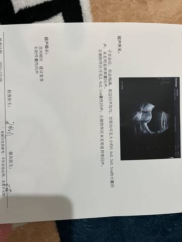 journal_insert_pic_1676617961