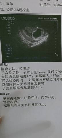 journal_insert_pic_1675763661