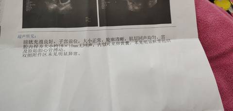 journal_insert_pic_1682068090