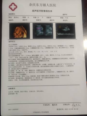 journal_insert_pic_1677429307