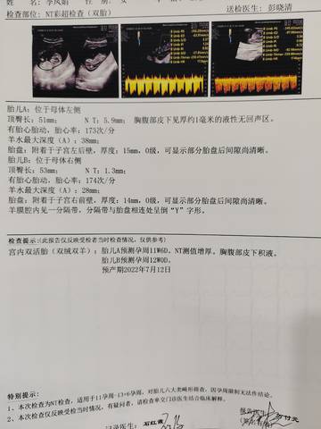 journal_insert_pic_1687803258