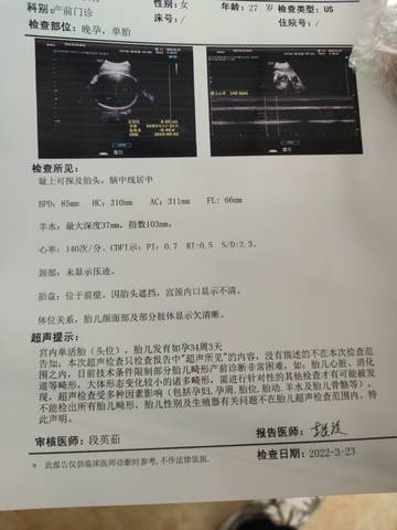 journal_insert_pic_1740991844