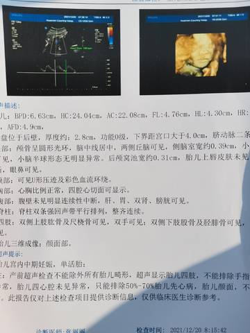 journal_insert_pic_1682953557