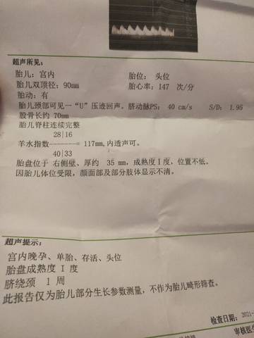 journal_insert_pic_1677599664