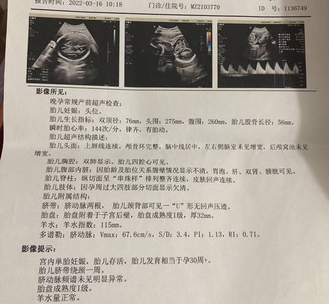 journal_insert_pic_1740817555