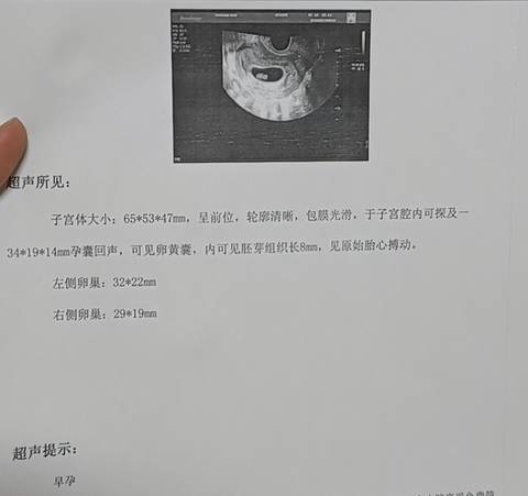journal_insert_pic_1675247016