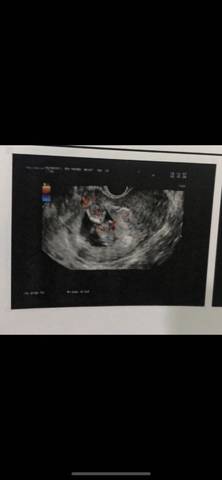 journal_insert_pic_1675020801