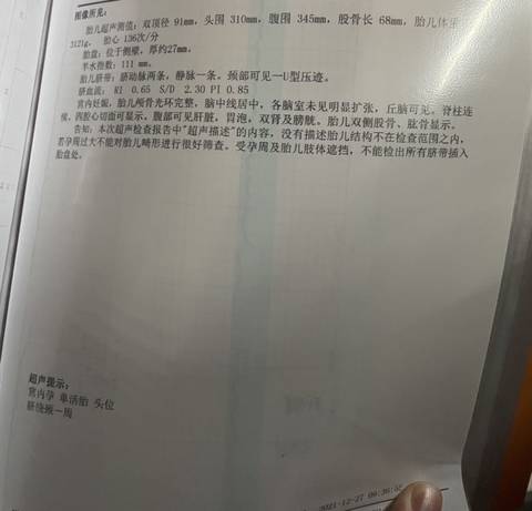 journal_insert_pic_1689039314