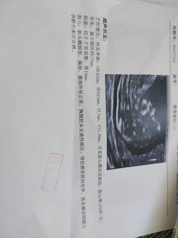 journal_insert_pic_1673498631