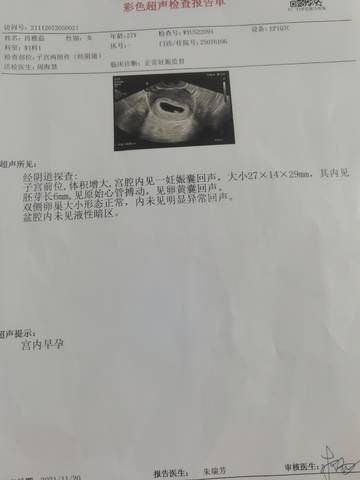 journal_insert_pic_1677053077