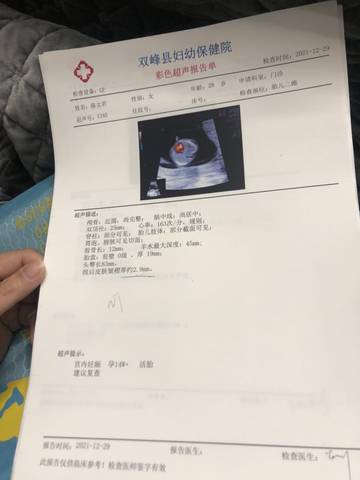 journal_insert_pic_1688496153