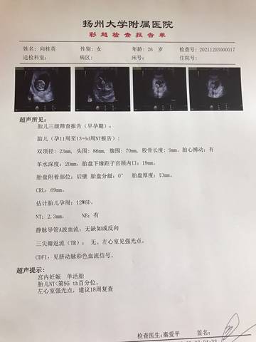journal_insert_pic_1673431964