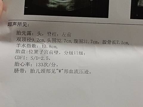 journal_insert_pic_1678024955