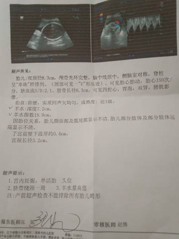 journal_insert_pic_1719512527