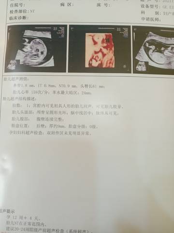 journal_insert_pic_1689229943