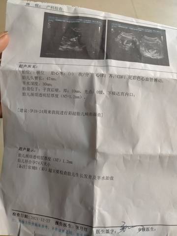 journal_insert_pic_1687268694