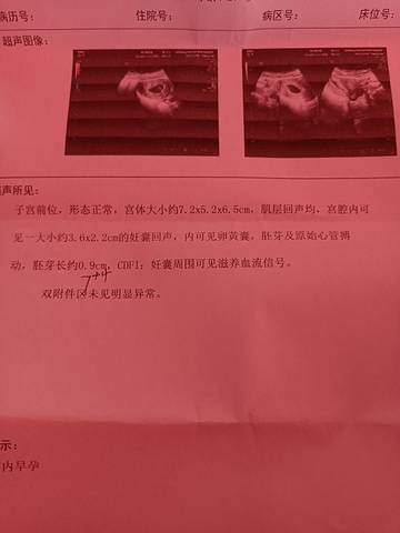 journal_insert_pic_1674866411