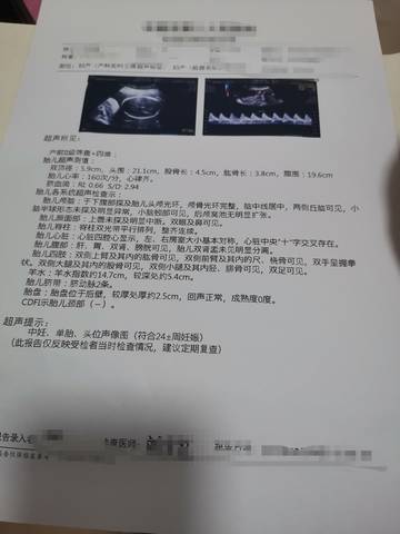 journal_insert_pic_1675233047