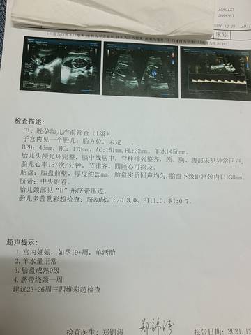 journal_insert_pic_1683746074
