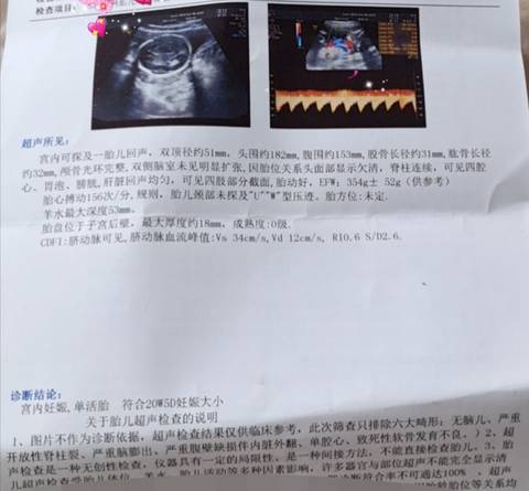 journal_insert_pic_1683385970