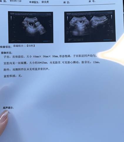 journal_insert_pic_1676443259