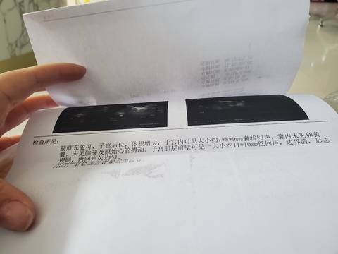 journal_insert_pic_1740954441