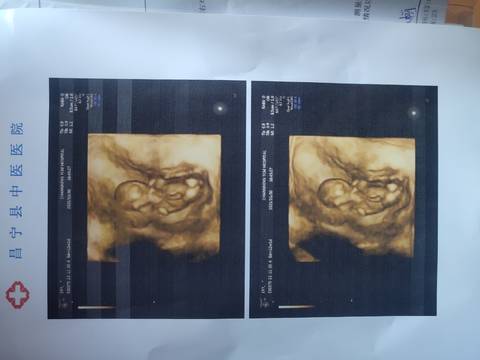 journal_insert_pic_1675354196